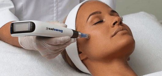 Dermapen 4 treatment Image of a woman having a Dermapen microneedling treatment