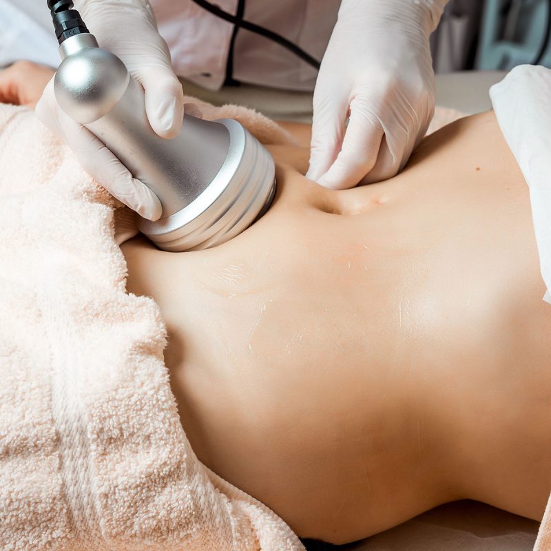 body-revival-web Skin tightening Christchurch NZ