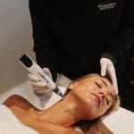 Woman having a dermapen microneedling skin treatment