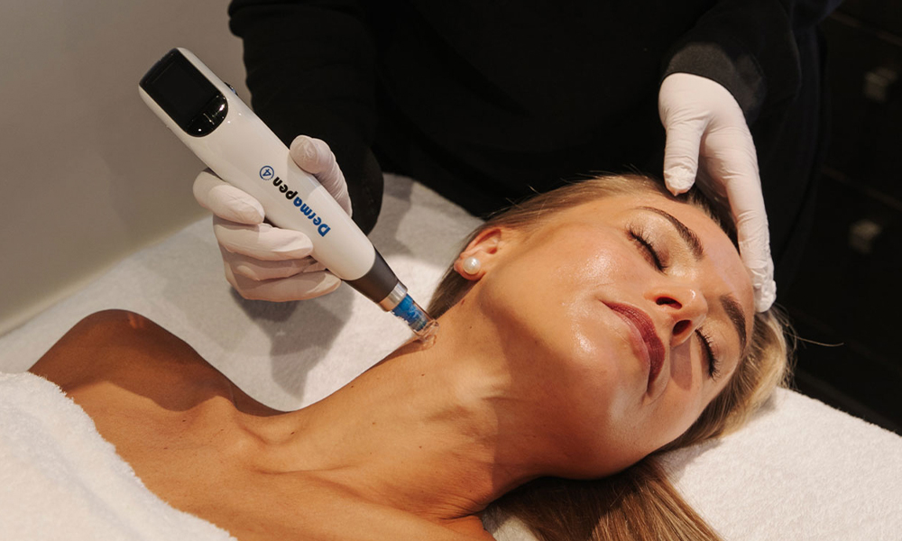 woman having dermapen microneedling in Christchurch