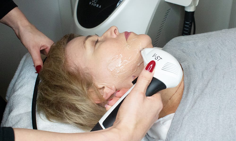 woman having IPL treatment