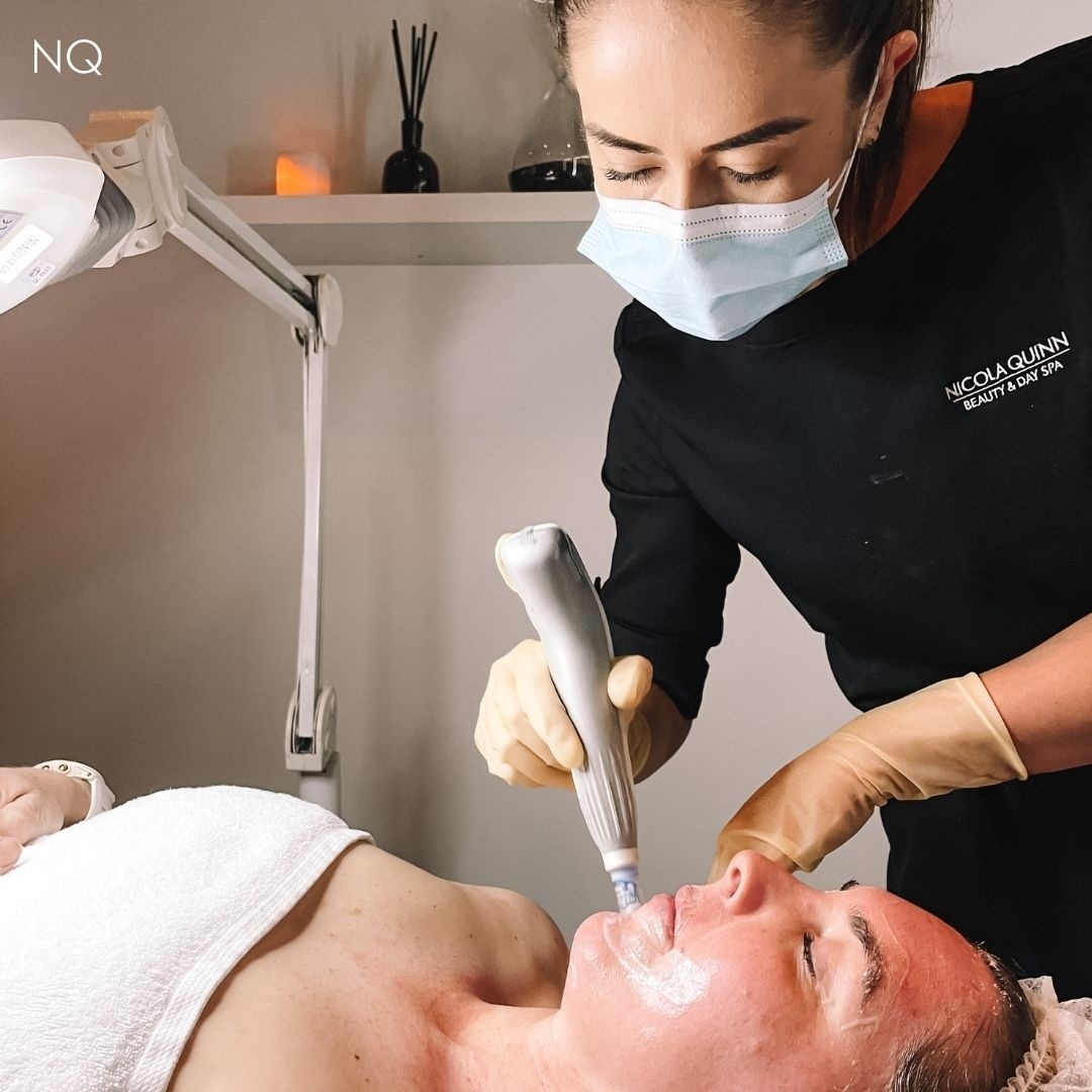 Achieve skin confidence & a glowing complexion with Dermapen! Minimise the signs of ageing and reduce fine lines, wrinkles, acne scars, pigmentation and more with one of the most popular skin needling treatments in the world, Dermapen Microneedling.⁠
⁠
See treatment before and after photos plus learn more about this treatment via our Linkin.bio