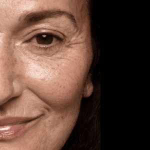 woman smiling with fine lines and age spots, pigmentation