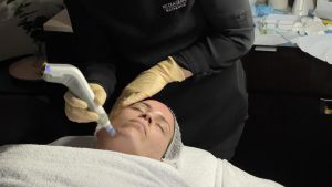 Angela getting dermapen treatment at nicola quinn beauty and day spa
