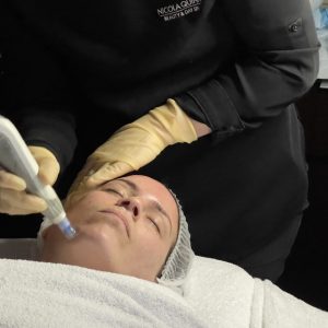 Angela getting dermapen treatment at nicola quinn beauty and day spa